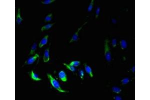 Immunofluorescent analysis of Hela cells using ABIN7159399 at dilution of 1:100 and Alexa Fluor 488-congugated AffiniPure Goat Anti-Rabbit IgG(H+L) (MS4A7 抗体  (AA 1-47))