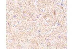 Immunohistochemistry of VISA in mouse brain tissue with this product at 2. (MAVS 抗体  (Middle Region))