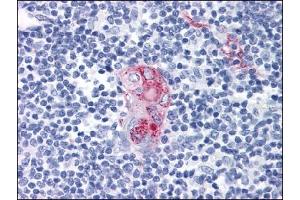 Immunohistochemistry (IHC) image for anti-CD1d Molecule (CD1D) antibody (ABIN614443) (CD1d 抗体)