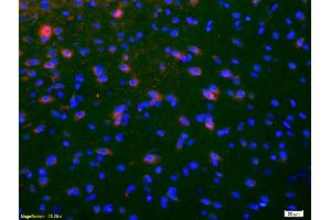 Formalin-fixed and paraffin-embedded rat brain labeled with Anti-NKB Polyclonal Antibody, Unconjugated (ABIN724460) 1:200, overnight at 4°C, The secondary antibody was Goat Anti-Rabbit IgG,Cy3 conjugated used at 1:200 dilution for 40 minutes at 37°C. (Tachykinin 3 抗体  (AA 81-90))