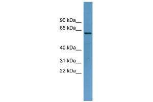 WB Suggested Anti-TOM1 Antibody Titration: 0. (TOM1 抗体  (Middle Region))