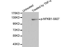 Western blot analysis of extracts from HL60 cells using Phospho-NFKB1-S927 antibody.