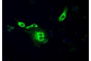 Image no. 6 for anti-P450 (Cytochrome) Oxidoreductase (POR) antibody (ABIN1497743) (POR 抗体)