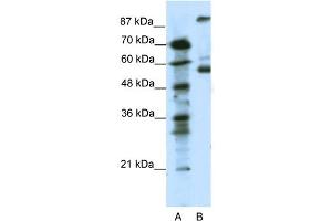 WB Suggested Anti-HTR7 Antibody Titration: 0. (HTR7 抗体  (N-Term))