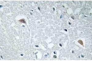Immunohistochemistry analysis of Synapsin-1 Antibody in paraffin-embedded human brain tissue. (SYN1 抗体)