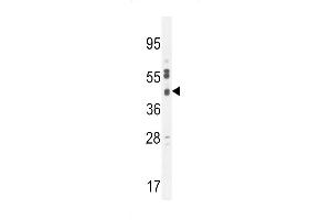 C Antibody (C-term) (ABIN654459 and ABIN2844192) western blot analysis in  cell line lysates (35 μg/lane). (SLC35F6 抗体  (C-Term))