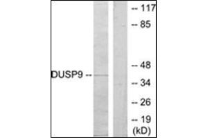 Western blot analysis of extracts from HeLa cells, using DUSP9 Antibody . (DUSP9 抗体  (Internal Region))