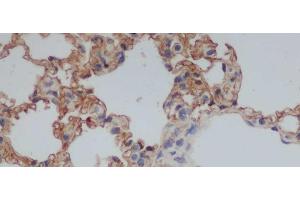 Immunohistochemistry of paraffin-embedded Rat lung using CD244 Polyclonal Antibody at dilution of 1:50 (2B4 抗体)