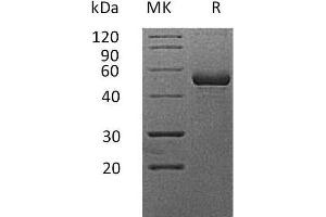 Tumor Necrosis Factor (Ligand) Superfamily, Member 13 (TNFSF13) protein (Fc Tag)