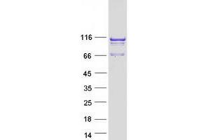 Western Blotting (WB) image for Sperm Associated Antigen 1 (SPAG1) (Transcript Variant 1) protein (Myc-DYKDDDDK Tag) (ABIN2732486)