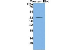 Western Blotting (WB) image for Myosin Heavy Chain 6, Cardiac Muscle, alpha (MYH6) ELISA Kit (ABIN6574317)