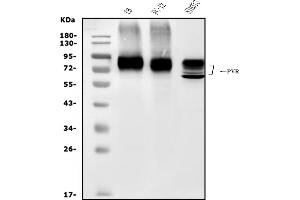 Western blot analysis of Poliovirus Receptor/PVR using anti-Poliovirus Receptor/PVR antibody (ABIN7600826).