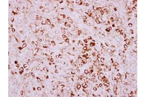 Image no. 1 for anti-Transmembrane Protease, serine 11D (TMPRSS11D) (AA 152-388) antibody (ABIN1501444) (TMPRSS11D 抗体  (AA 152-388))