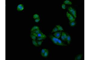 Immunofluorescence staining of HepG2 cells with ABIN7163230 at 1:200, counter-stained with DAPI. (PICALM 抗体  (AA 517-624))