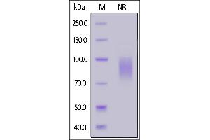SDS-PAGE (SDS) image for Killer Cell Lectin-Like Receptor Subfamily K, Member 1 (KLRK1) (AA 73-216) (Active) protein (Fc Tag,FITC) (ABIN7013619)