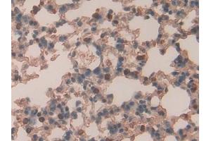 Detection of RARa in Mouse Lung Tissue using Polyclonal Antibody to Retinoic Acid Receptor Alpha (RARa) (Retinoic Acid Receptor alpha 抗体  (AA 237-459))