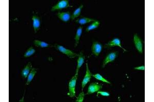 Immunofluorescent analysis of Hela cells using ABIN7142472 at dilution of 1:100 and Alexa Fluor 488-congugated AffiniPure Goat Anti-Rabbit IgG(H+L) (ALDH9A1 抗体  (AA 12-144))