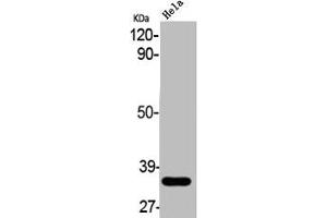 Western Blot analysis of HELA cells using ABCC13 Polyclonal Antibody (ABCC13 抗体  (Internal Region))