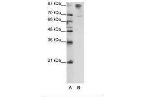 Image no. 3 for anti-HKR1, GLI-Kruppel Zinc Finger Family Member (HKR1) (C-Term) antibody (ABIN6736165) (HKR1 抗体  (C-Term))