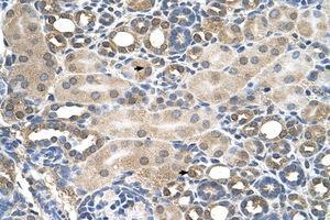 Image no. 1 for anti-Hemochromatosis (HFE) (AA 149-198) antibody (ABIN6736669) (HFE 抗体  (AA 149-198))