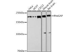Western blot analysis of extracts of various cell lines, using RhoGAP Rabbit mAb (ABIN1682830, ABIN3016006, ABIN3016007 and ABIN7101474) at 1:1000 dilution. (ARHGAP5 抗体)