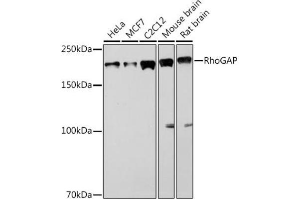 ARHGAP5 抗体