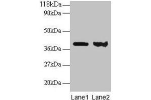 Western blot All lanes: ARHGDIA antibody at 2 μg/mL Lane 1: EC109 whole cell lysate Lane 2: 293T whole cell lysate Secondary Goat polyclonal to rabbit IgG at 1/15000 dilution Predicted band size: 24, 19 kDa Observed band size: 40 kDa (ARHGDIA 抗体  (AA 2-204))