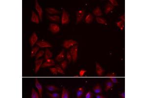 Immunofluorescence analysis of U2OS cells using PDXK Polyclonal Antibody (PDXK 抗体)
