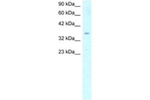 Western Blotting (WB) image for anti-Stearoyl-CoA Desaturase (Delta-9-Desaturase) (SCD) antibody (ABIN2460578) (SCD 抗体)