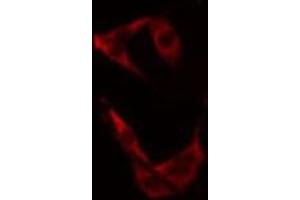 ABIN6275710 staining 293 cells by IF/ICC. (TACC3 抗体  (C-Term))