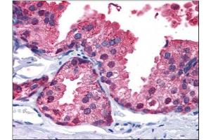 Immunohistochemistry Image: Human Prostate: Formalin-Fixed, Paraffin-Embedded (FFPE) (PDE4B 抗体  (C-Term))