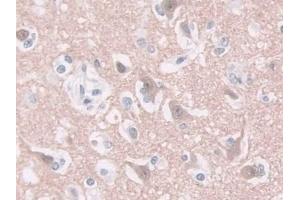 Detection of GDA in Human Cerebrum Tissue using Polyclonal Antibody to Guanine Deaminase (GDA) (GDA 抗体  (AA 1-454))