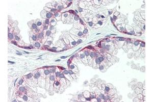 Human Prostate (formalin-fixed, paraffin-embedded) stained with SDC1at 15 µg/ml followed by biotinylated goat anti-rabbit IgG secondary antibody, alkaline phosphatase-streptavidin and chromogen.