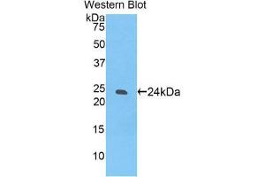 Western Blotting (WB) image for anti-Sialic Acid Binding Ig-Like Lectin 12 (SIGLEC12) (AA 22-218) antibody (ABIN1174410) (SIGLEC12 抗体  (AA 22-218))