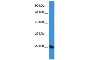 Western Blot showing DUX3 antibody used at a concentration of 1.