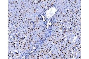 IHC analysis of U1A/SNRPA using anti-U1A/SNRPA antibody (ABIN7600891). (SNRPA1 抗体  (AA 25-218))