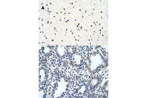 Immunohistochemical staining (Formalin-fixed paraffin-embedded sections) of human brain (A) and lung (B) with BLZF1 polyclonal antibody  at 4-8 ug/mL working concentration. (BLZF1 抗体  (C-Term))