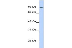 WB Suggested Anti-FOLH1 Antibody Titration:  0. (PSMA 抗体  (C-Term))