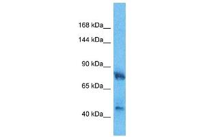 Host:  Rabbit  Target Name:  HMGCR  Sample Type:  Fetal Lung lysates  Antibody Dilution:  1.