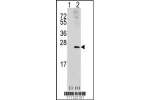 Western blot analysis of RAC1 using rabbit polyclonal RAC1 Antibody (S71). (RAC1 抗体  (AA 49-78))