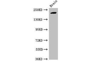 Western Blot Positive WB detected in: Mouse brain tissue All lanes: RBBP6 antibody at 2. (RBBP6 抗体  (AA 51-97))