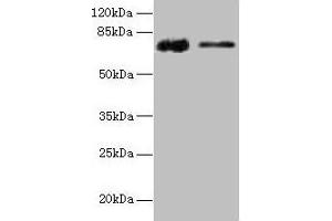 Western blot All lanes: GLCE antibody at 12 μg/mL Lane 1: Rat liver tissue Lane 2: Mouse kidney tissue Secondary Goat polyclonal to rabbit IgG at 1/10000 dilution Predicted band size: 71 kDa Observed band size: 71 kDa (GLCE 抗体  (AA 29-617))