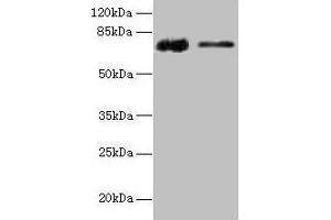 Western blot All lanes: GLCE antibody at 12 μg/mL Lane 1: Rat liver tissue Lane 2: Mouse kidney tissue Secondary Goat polyclonal to rabbit IgG at 1/10000 dilution Predicted band size: 71 kDa Observed band size: 71 kDa