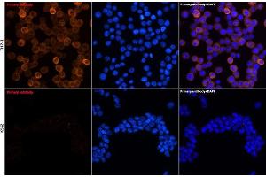 Immunofluorescence analysis of THP-1 and K562 cells using YKL-40/CHI3L1 Rabbit mAb (ABIN7266328) at dilution of 1:100 (40x lens).