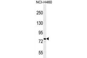 Western Blotting (WB) image for anti-helicase 2, X-linked (ATRX) antibody (ABIN2996469) (ATRX 抗体)