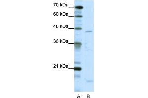 WB Suggested Anti-TRIAntibody Titration:  5. (TRIP13 抗体  (C-Term))