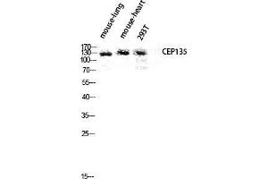 Western Blot (WB) analysis of Mouse Lung Mouse Heart 293T lysis using CEP135 antibody. (CEP135 抗体  (C-Term))