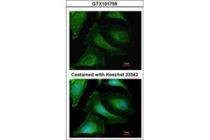 Image no. 3 for anti-Creatine Kinase, Brain (CKB) (AA 66-179) antibody (ABIN467367) (CKB 抗体  (AA 66-179))
