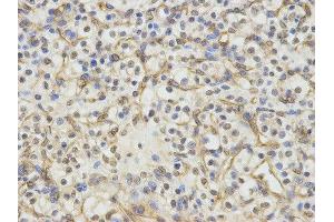 Immunohistochemistry (IHC) image for anti-Excision Repair Cross Complementing Polypeptide-1 (ERCC1) antibody (ABIN1876479) (ERCC1 抗体)