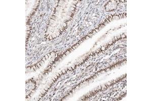 Immunohistochemical staining of human cervix, uterine, with LARP7 polyclonal antibody  shows nuclear positivity in glandular cells. (LARP7 抗体)